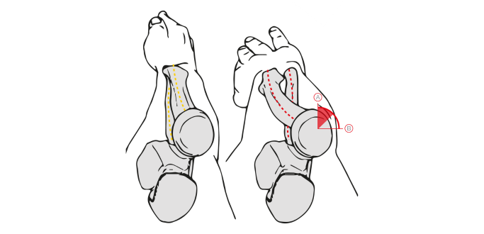 syndrome canal carpien_souris ergonomique_bakkerelkhuizen